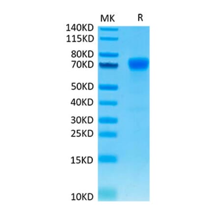 Tris-Bis PAGE - Recombinant Human PD-L1 Protein (C-terminal Mouse Fc Tag) (A331155) - Antibodies.com
