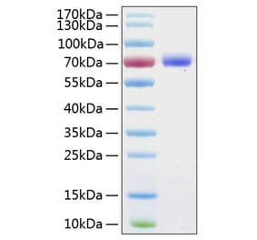 SDS-PAGE - Recombinant Human PD-L1 Protein (C-terminal Human Fc and His Tag) (A331156) - Antibodies.com