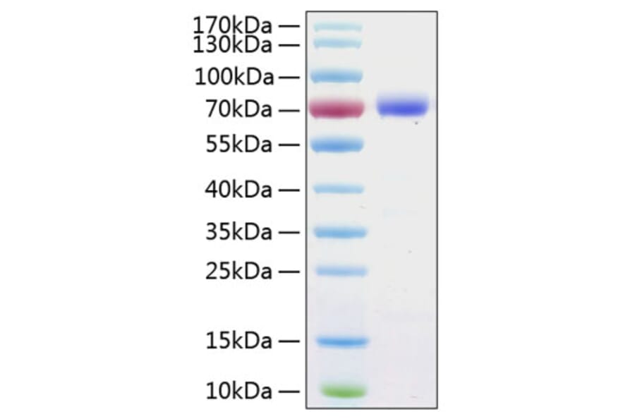 SDS-PAGE - Recombinant Human PD-L1 Protein (C-terminal Human Fc and His Tag) (A331156) - Antibodies.com