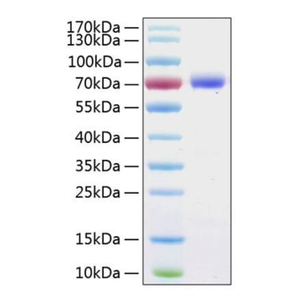 SDS-PAGE - Recombinant Human PD-L1 Protein (C-terminal Human Fc and His Tag) (A331156) - Antibodies.com