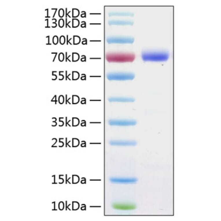 SDS-PAGE - Recombinant Human PD-L1 Protein (C-terminal Human Fc and His Tag) (A331156) - Antibodies.com