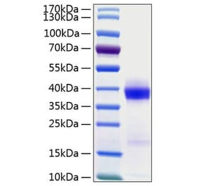 SDS-PAGE - Recombinant Human PD-L1 Protein (C-terminal His Tag) (A331157) - Antibodies.com