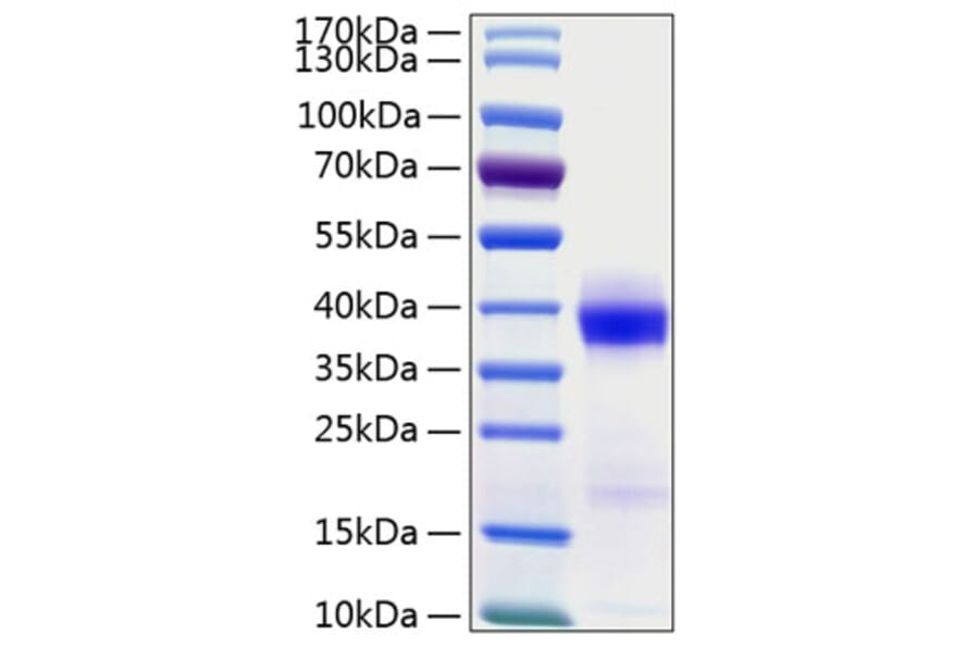 SDS-PAGE - Recombinant Human PD-L1 Protein (C-terminal His Tag) (A331157) - Antibodies.com