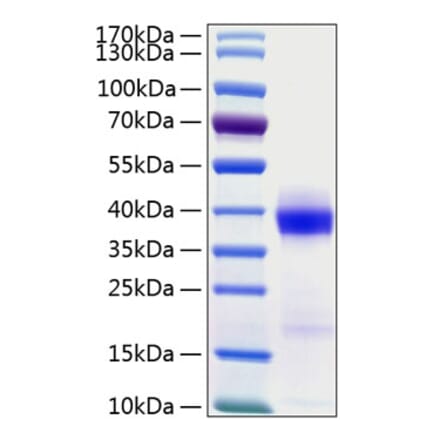 SDS-PAGE - Recombinant Human PD-L1 Protein (C-terminal His Tag) (A331157) - Antibodies.com