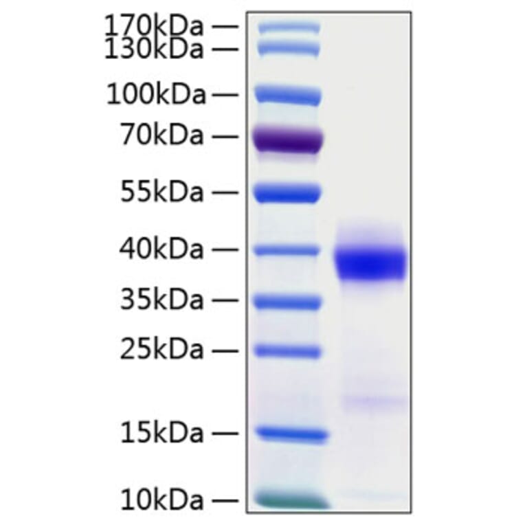 SDS-PAGE - Recombinant Human PD-L1 Protein (C-terminal His Tag) (A331157) - Antibodies.com