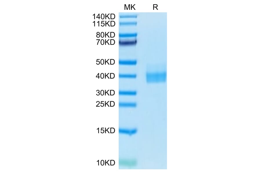 Tris-Bis PAGE - Recombinant Human PD-L1 Protein (Biotin) (C-terminal His and Avi Tag) (A331158) - Antibodies.com