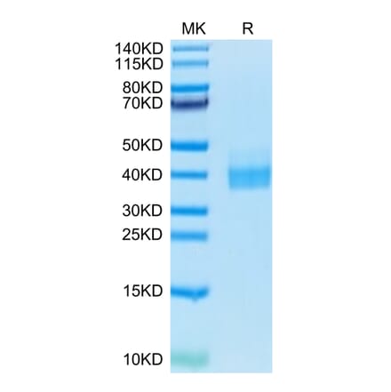 Tris-Bis PAGE - Recombinant Human PD-L1 Protein (Biotin) (C-terminal His and Avi Tag) (A331158) - Antibodies.com