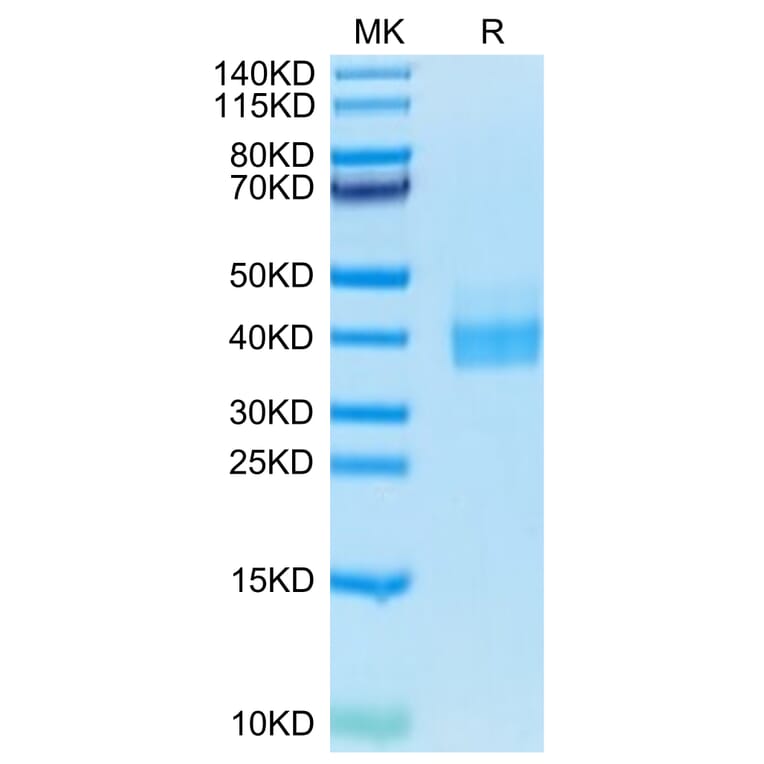 Tris-Bis PAGE - Recombinant Human PD-L1 Protein (Biotin) (C-terminal His and Avi Tag) (A331158) - Antibodies.com