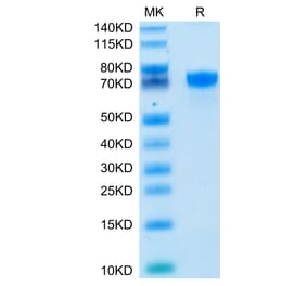 Tris-Bis PAGE - Recombinant Human PD-L1 Protein (C-terminal Human Fc Tag) (A331159) - Antibodies.com