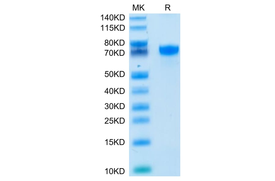 Tris-Bis PAGE - Recombinant Human PD-L1 Protein (C-terminal Human Fc Tag) (A331159) - Antibodies.com