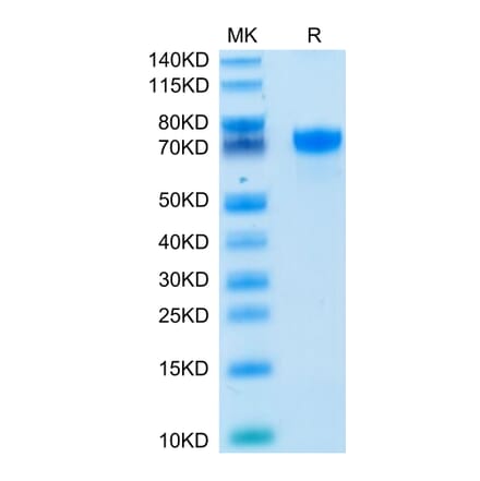 Tris-Bis PAGE - Recombinant Human PD-L1 Protein (C-terminal Human Fc Tag) (A331159) - Antibodies.com
