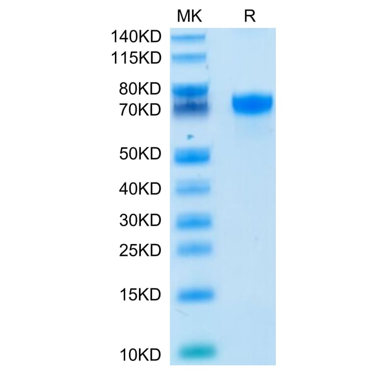 Tris-Bis PAGE - Recombinant Human PD-L1 Protein (C-terminal Human Fc Tag) (A331159) - Antibodies.com