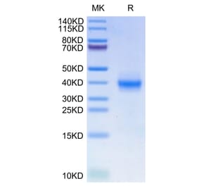 Tris-Bis PAGE - Recombinant Human PD-L1 Protein (C-terminal His Tag) (A331160) - Antibodies.com