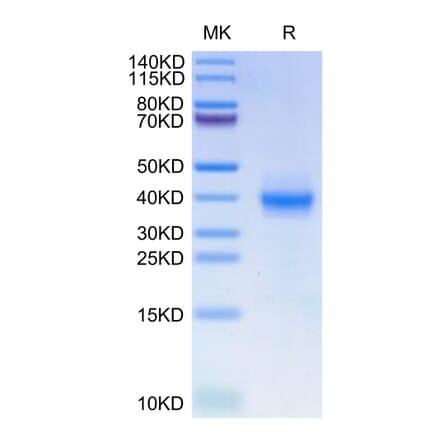 Tris-Bis PAGE - Recombinant Human PD-L1 Protein (C-terminal His Tag) (A331160) - Antibodies.com
