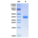 Tris-Bis PAGE - Recombinant Human PD-L1 Protein (C-terminal His Tag) (A331160) - Antibodies.com