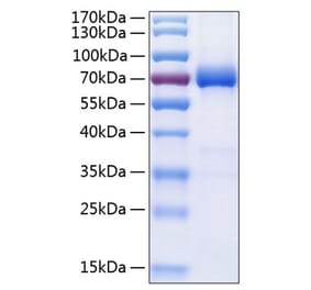 SDS-PAGE - Recombinant Human PD-L2 Protein (C-terminal Human Fc and His Tag) (A331161) - Antibodies.com