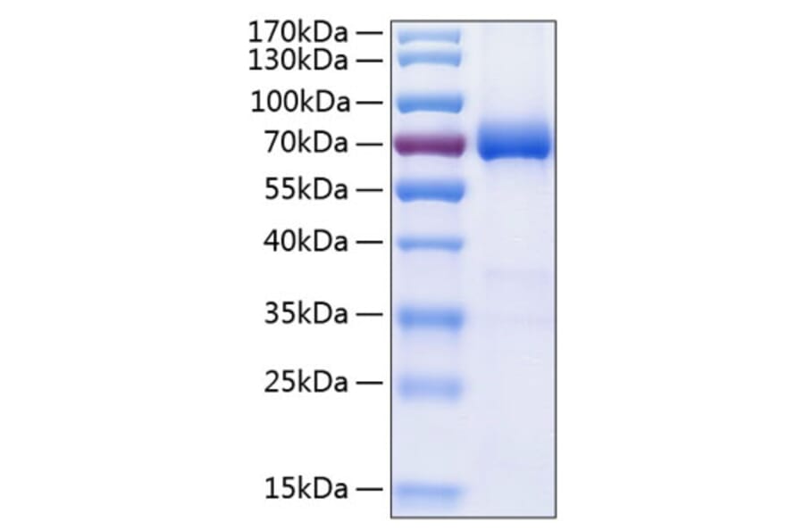SDS-PAGE - Recombinant Human PD-L2 Protein (C-terminal Human Fc and His Tag) (A331161) - Antibodies.com