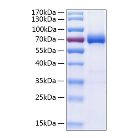 SDS-PAGE - Recombinant Human PD-L2 Protein (C-terminal Human Fc and His Tag) (A331161) - Antibodies.com