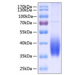 SDS-PAGE - Recombinant Human PD-L2 Protein (C-terminal His Tag) (A331162) - Antibodies.com