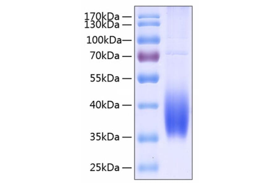 SDS-PAGE - Recombinant Human PD-L2 Protein (C-terminal His Tag) (A331162) - Antibodies.com