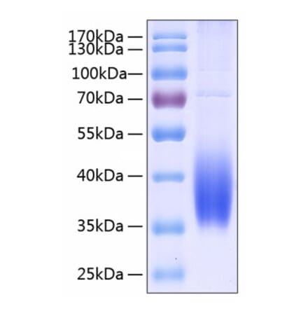 SDS-PAGE - Recombinant Human PD-L2 Protein (C-terminal His Tag) (A331162) - Antibodies.com