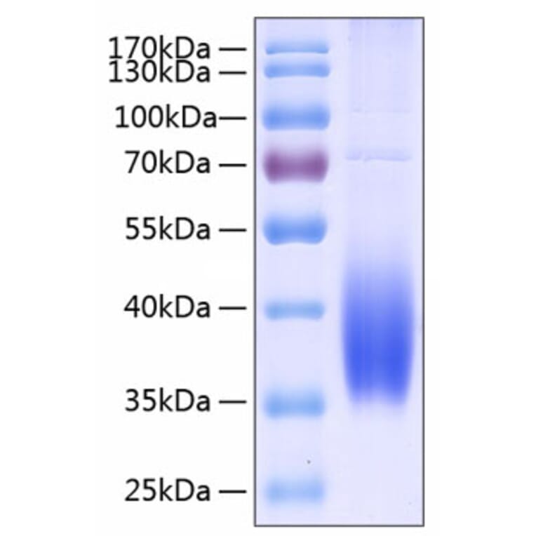 SDS-PAGE - Recombinant Human PD-L2 Protein (C-terminal His Tag) (A331162) - Antibodies.com