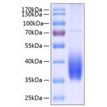 SDS-PAGE - Recombinant Human PD-L2 Protein (C-terminal His Tag) (A331162) - Antibodies.com