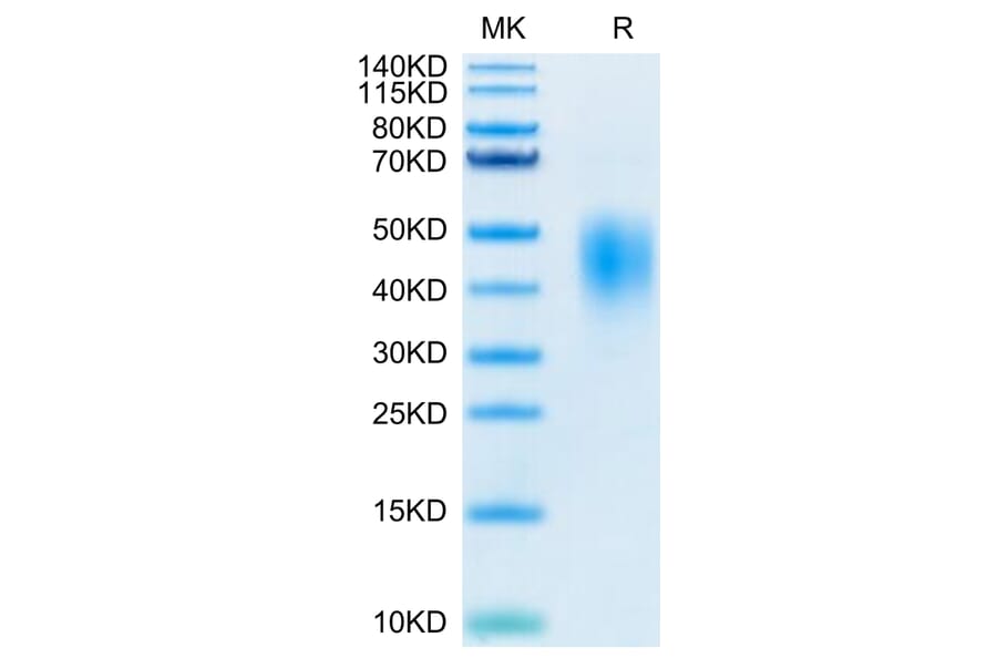Tris-Bis PAGE - Recombinant Human PD-L2 Protein (Biotin) (C-terminal His and Avi Tag) (A331163) - Antibodies.com