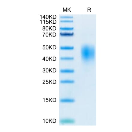 Tris-Bis PAGE - Recombinant Human PD-L2 Protein (Biotin) (C-terminal His and Avi Tag) (A331163) - Antibodies.com