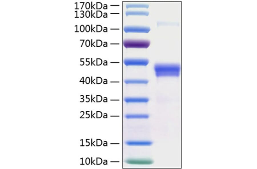 SDS-PAGE - Recombinant Human Pentraxin 3/PTX3 Protein (C-terminal His Tag) (A331166) - Antibodies.com