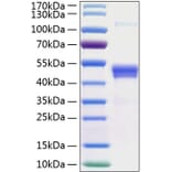 SDS-PAGE - Recombinant Human Pentraxin 3/PTX3 Protein (C-terminal His Tag) (A331166) - Antibodies.com