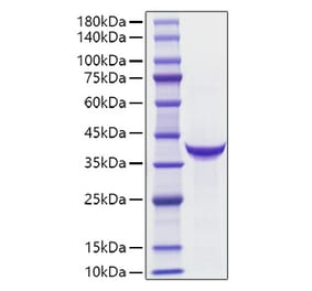 SDS-PAGE - Recombinant Human Pepsinogen II Protein (C-terminal His Tag) (A331167) - Antibodies.com