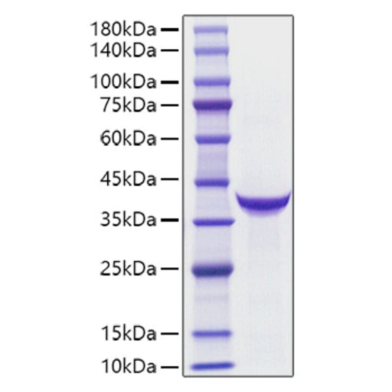 SDS-PAGE - Recombinant Human Pepsinogen II Protein (C-terminal His Tag) (A331167) - Antibodies.com