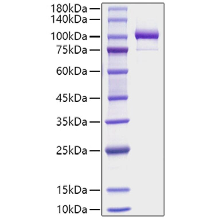 SDS-PAGE - Recombinant Human Periostin Protein (C-terminal His Tag) (A331168) - Antibodies.com