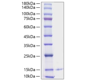 SDS-PAGE - Recombinant Human PF4 Protein (C-terminal His Tag) (A331169) - Antibodies.com