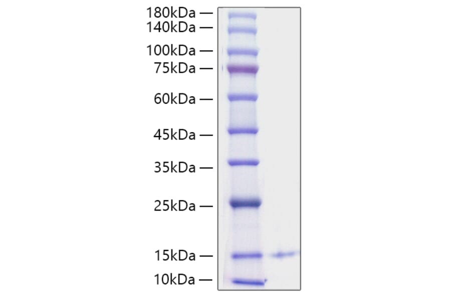 SDS-PAGE - Recombinant Human PF4 Protein (C-terminal His Tag) (A331169) - Antibodies.com