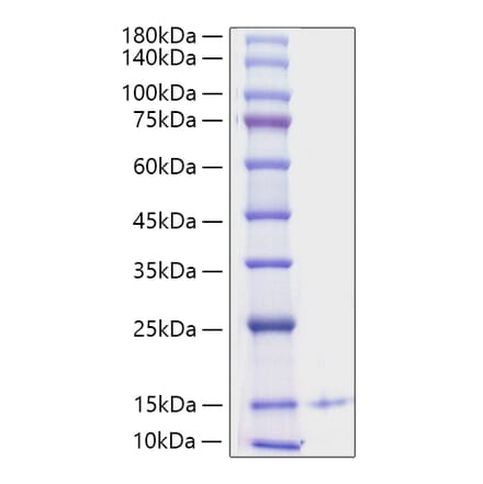 SDS-PAGE - Recombinant Human PF4 Protein (C-terminal His Tag) (A331169) - Antibodies.com
