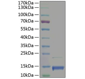 SDS-PAGE - Recombinant Human PF4 Protein (A331170) - Antibodies.com