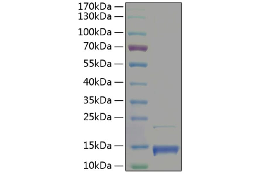 SDS-PAGE - Recombinant Human PF4 Protein (A331170) - Antibodies.com