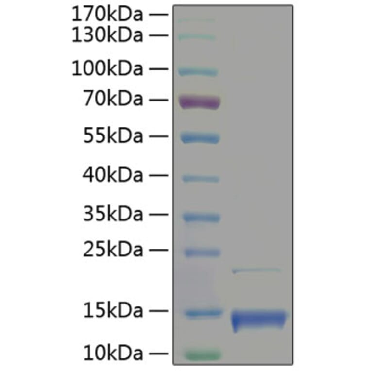 SDS-PAGE - Recombinant Human PF4 Protein (A331170) - Antibodies.com