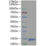 SDS-PAGE - Recombinant Human PF4 Protein (A331170) - Antibodies.com