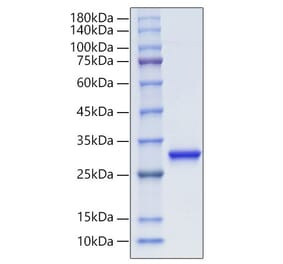 SDS-PAGE - Recombinant Human PGP9.5 Protein (C-terminal His Tag) (A331171) - Antibodies.com
