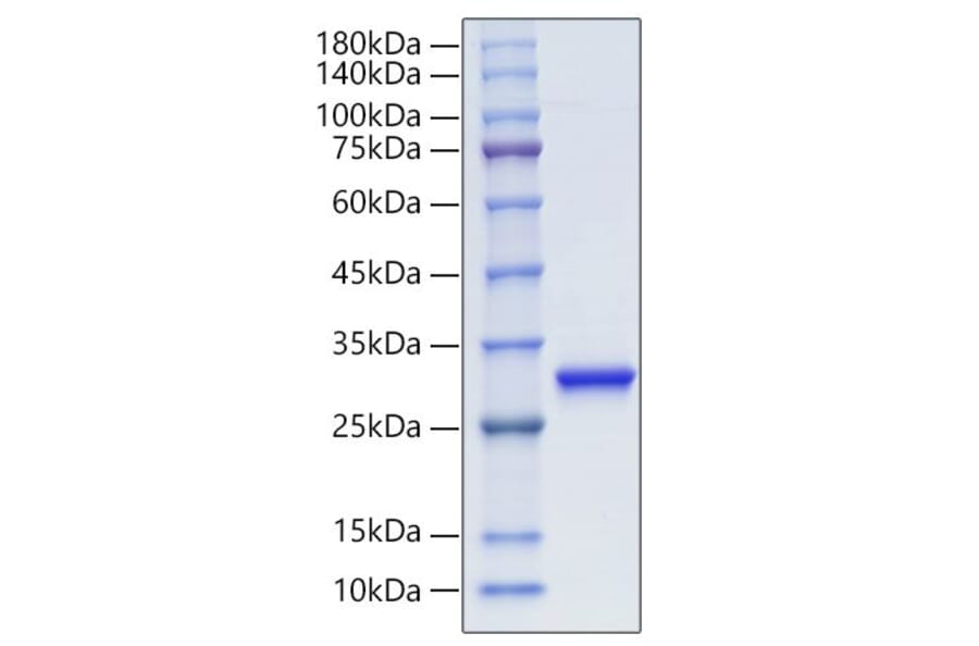 SDS-PAGE - Recombinant Human PGP9.5 Protein (C-terminal His Tag) (A331171) - Antibodies.com