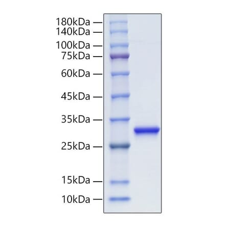 SDS-PAGE - Recombinant Human PGP9.5 Protein (C-terminal His Tag) (A331171) - Antibodies.com