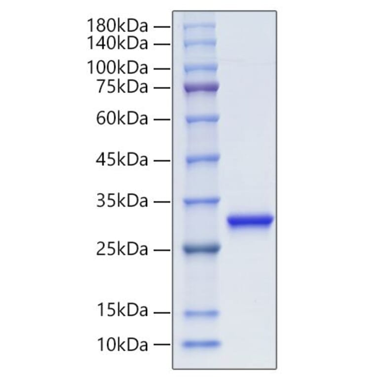 SDS-PAGE - Recombinant Human PGP9.5 Protein (C-terminal His Tag) (A331171) - Antibodies.com