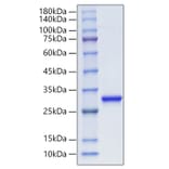 SDS-PAGE - Recombinant Human PGP9.5 Protein (C-terminal His Tag) (A331171) - Antibodies.com