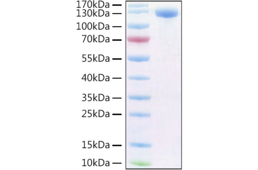 SDS-PAGE - Recombinant Human PIGR Protein (C-terminal Human Fc and Avi Tag) (A331173) - Antibodies.com