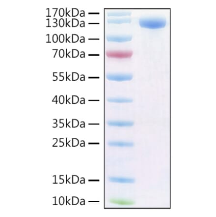 SDS-PAGE - Recombinant Human PIGR Protein (C-terminal Human Fc and Avi Tag) (A331173) - Antibodies.com