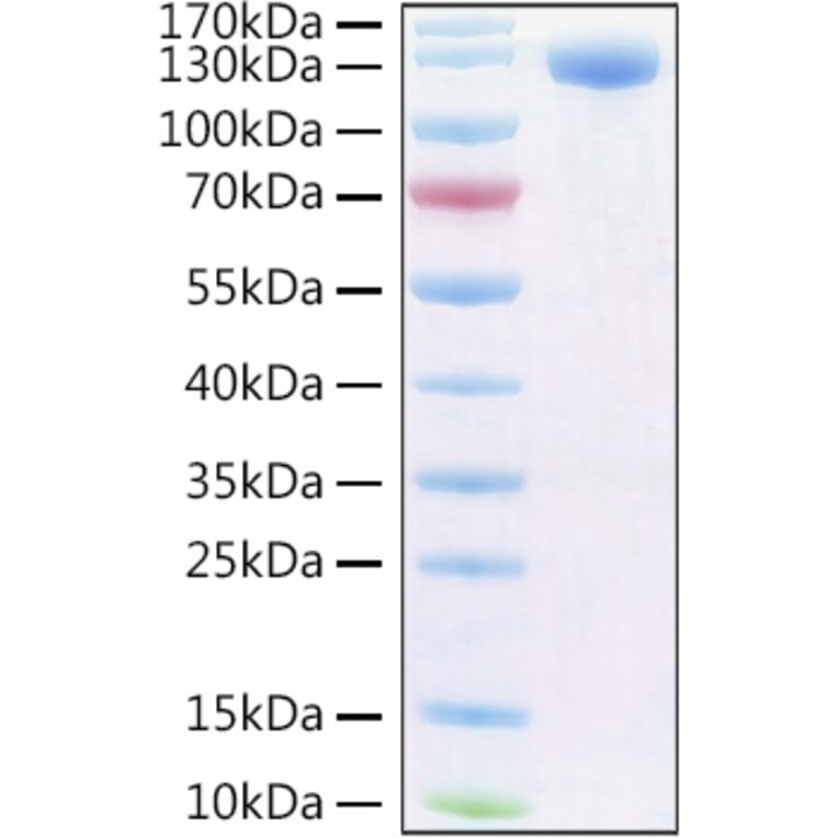 SDS-PAGE - Recombinant Human PIGR Protein (C-terminal Human Fc and Avi Tag) (A331173) - Antibodies.com