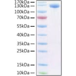 SDS-PAGE - Recombinant Human PIGR Protein (C-terminal Human Fc and Avi Tag) (A331173) - Antibodies.com